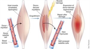 muscle growth soreness